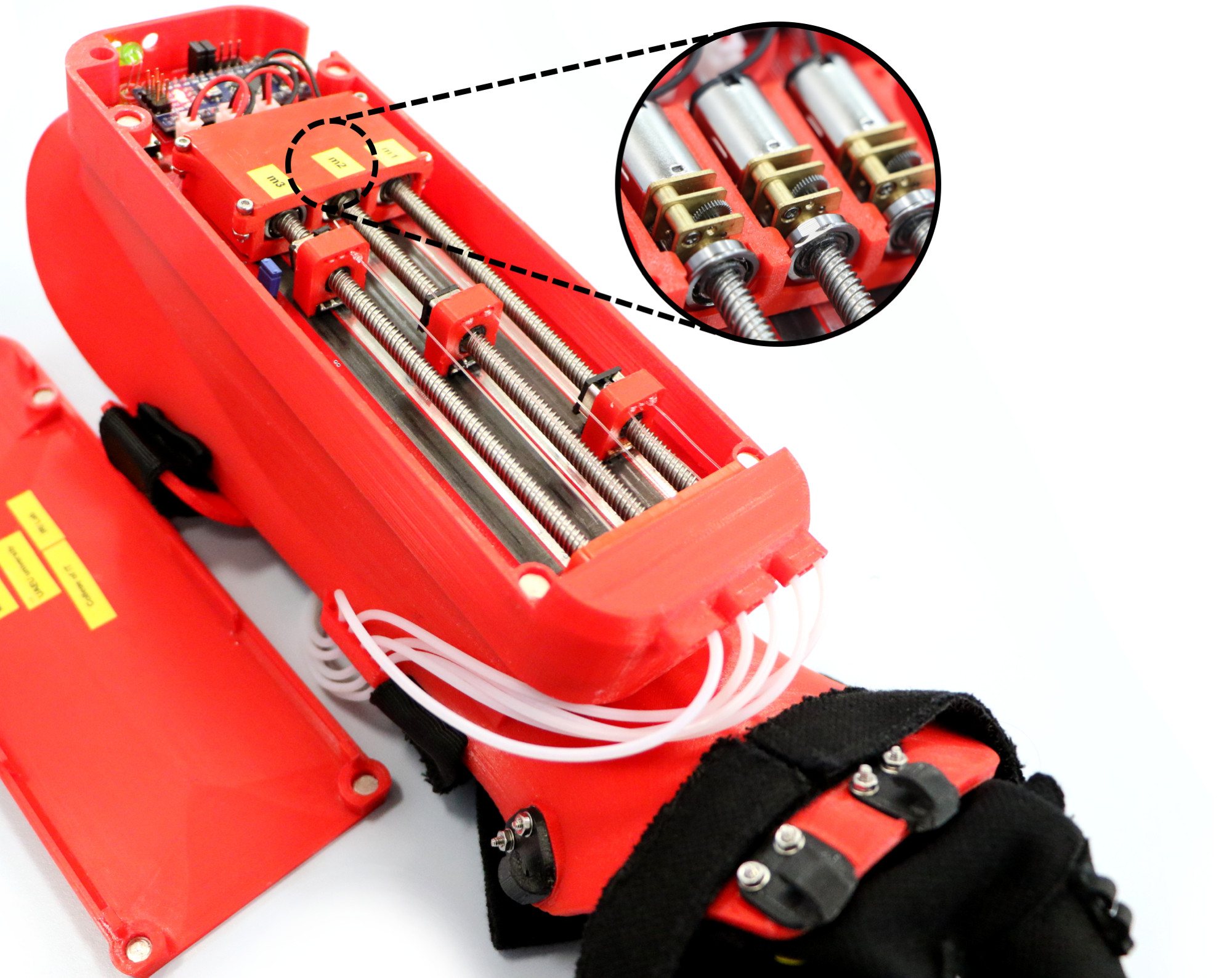 Hand Assistive Device for Stroke Patients